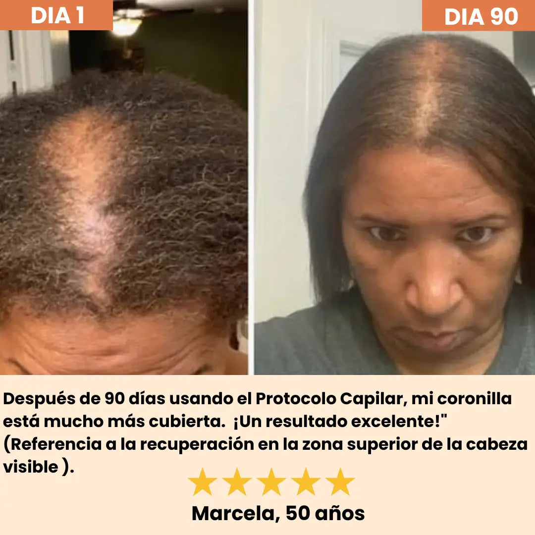 HELYORATTY™ Protocolo de restauración Capilar