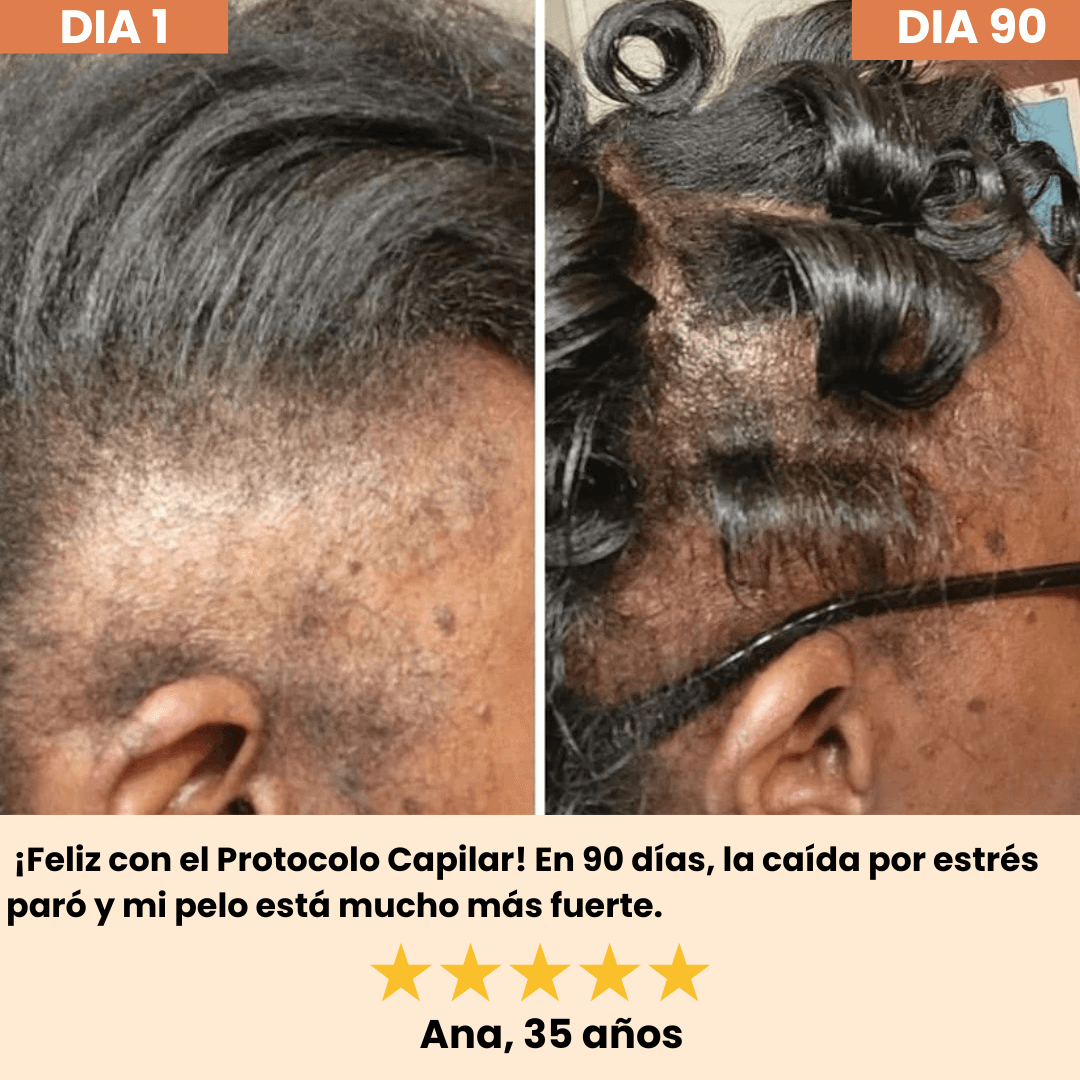 HELYORATTY™  Protocolo de restauración Capilar