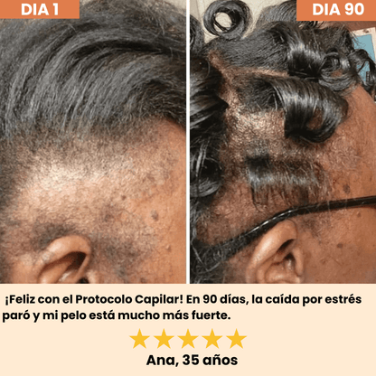 HELYORATTY™  Protocolo de restauración Capilar