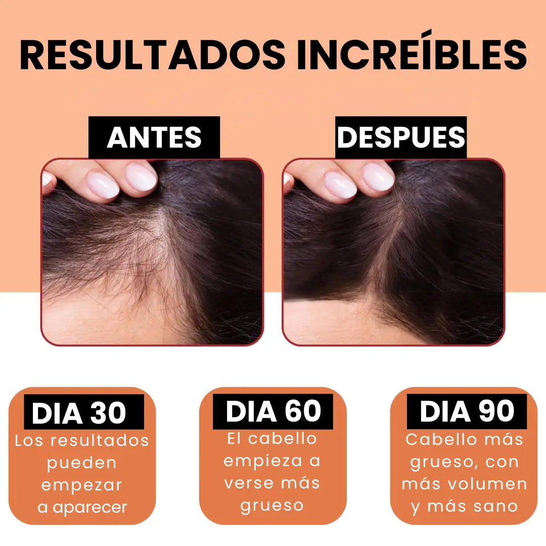 HELYORATTY™  Protocolo de restauración Capilar