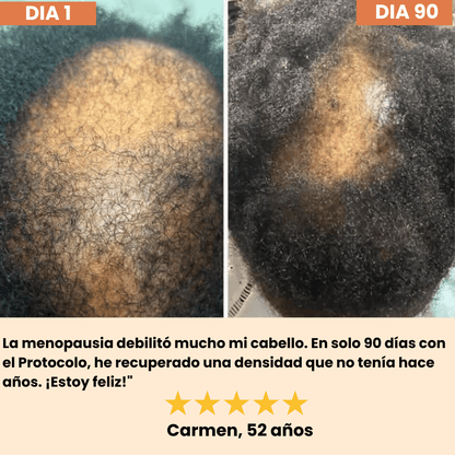 HELYORATTY™  Protocolo de restauración Capilar