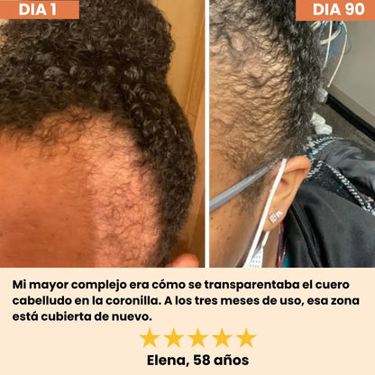 HELYORATTY™  Protocolo de restauración Capilar